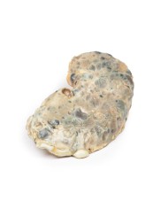 Malattia del rene policistico dell adulto Erler Zimmer 3D anatomy Series 