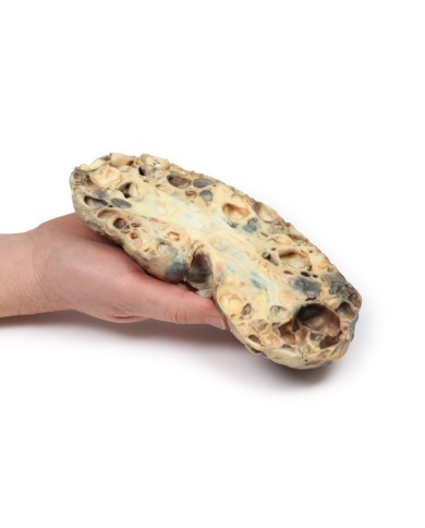 Malattia del rene policistico dell adulto Erler Zimmer 3D anatomy Series 