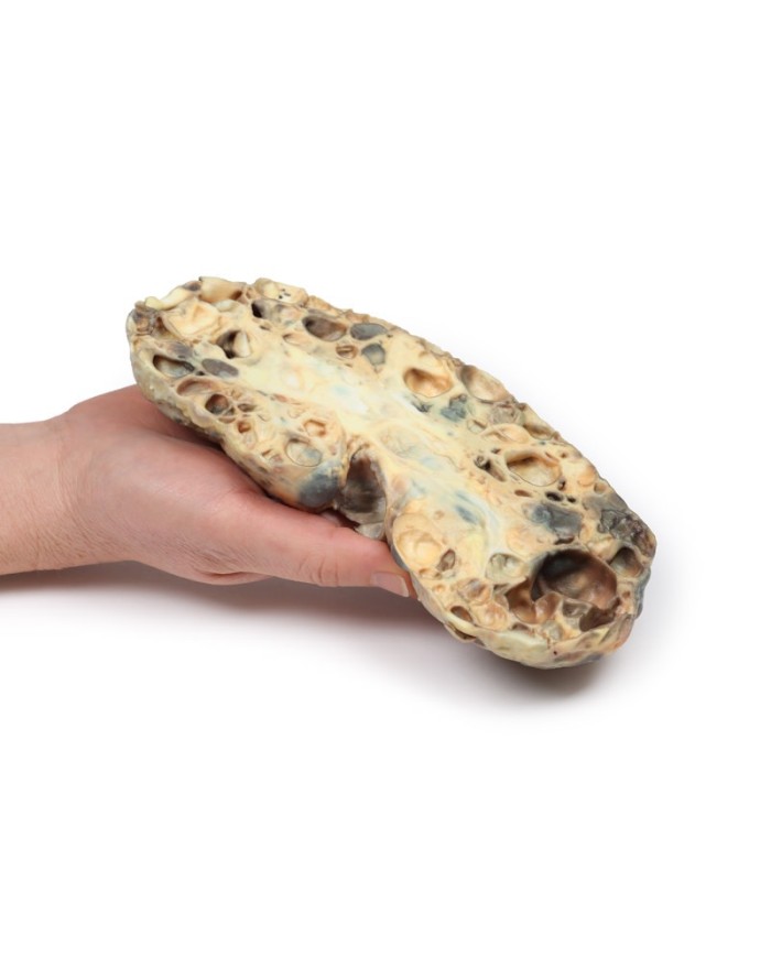 Malattia del rene policistico dell adulto Erler Zimmer 3D anatomy Series 