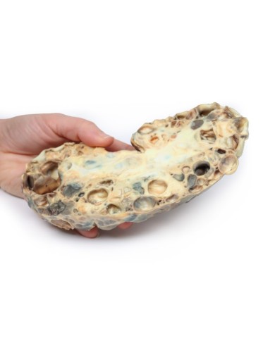 Malattia del rene policistico dell adulto Erler Zimmer 3D anatomy Series 