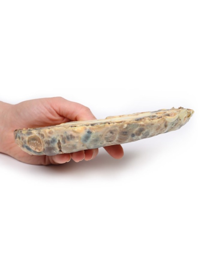 Malattia del rene policistico dell adulto Erler Zimmer 3D anatomy Series 