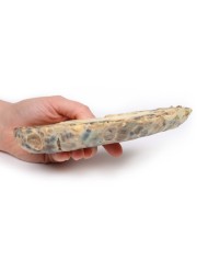 Malattia del rene policistico dell adulto Erler Zimmer 3D anatomy Series 