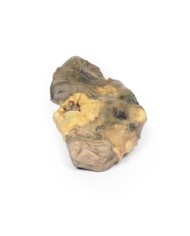 Pionefrosi Erler Zimmer 3D anatomy Series MP2096