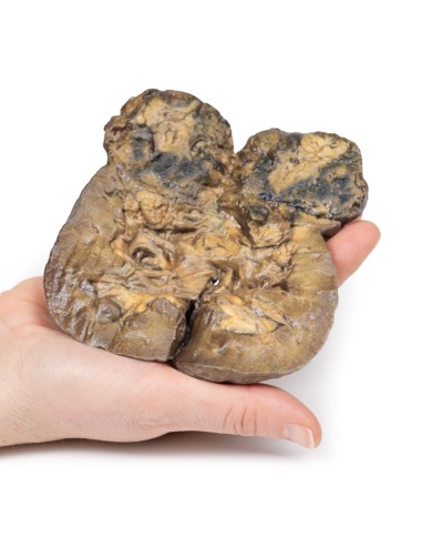 Carcinoma delle cellule renali Erler Zimmer 3D anatomy Series MP2097