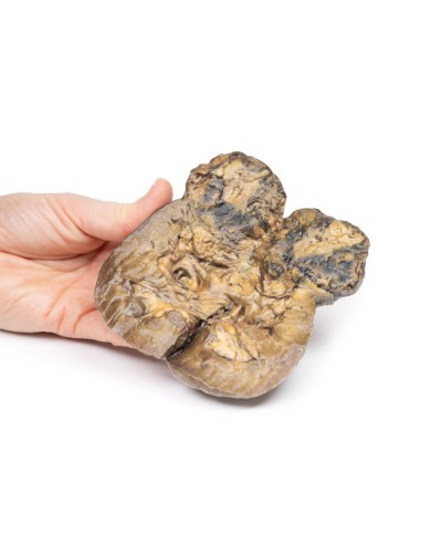 Carcinoma delle cellule renali Erler Zimmer 3D anatomy Series MP2097