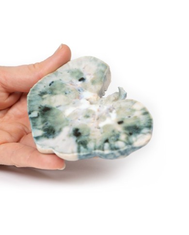 Infarto renale Erler Zimmer 3D anatomy Series MP2098