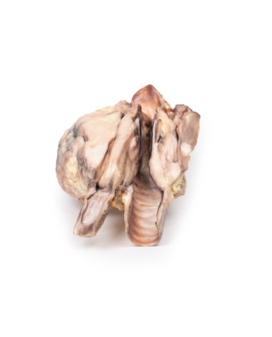 Linfoma della tiroide Erler Zimmer 3D anatomy Series MP2100