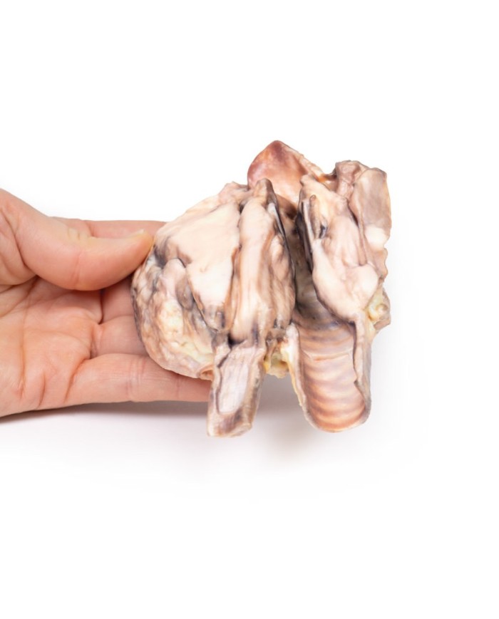 Linfoma della tiroide Erler Zimmer 3D anatomy Series MP2100