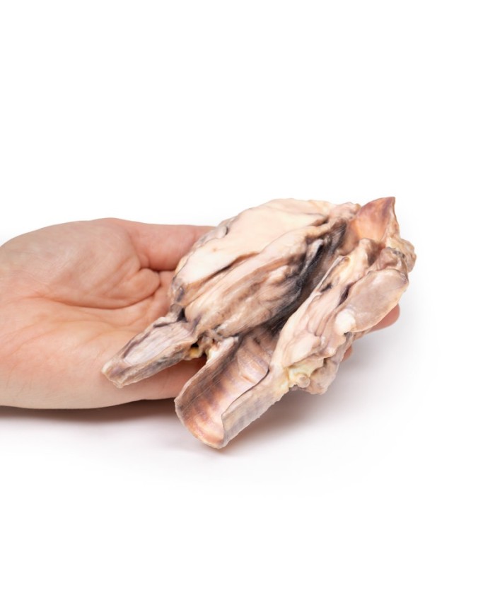 Linfoma della tiroide Erler Zimmer 3D anatomy Series MP2100