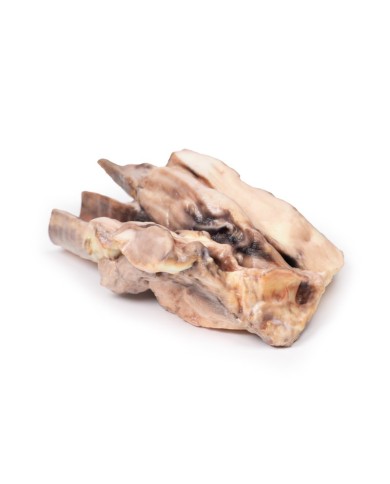 Linfoma della tiroide Erler Zimmer 3D anatomy Series MP2100