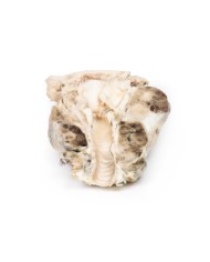 Gozzo multinodulare Erler Zimmer 3D anatomy Series MP2101