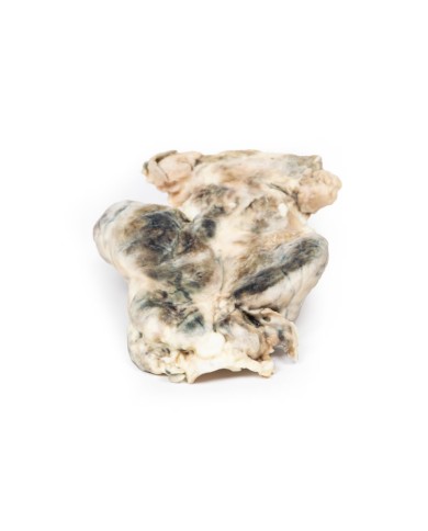 Gozzo multinodulare Erler Zimmer 3D anatomy Series MP2101