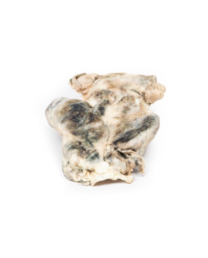 Gozzo multinodulare Erler Zimmer 3D anatomy Series MP2101