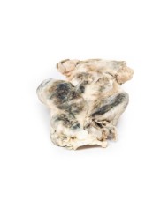 Gozzo multinodulare Erler Zimmer 3D anatomy Series MP2101