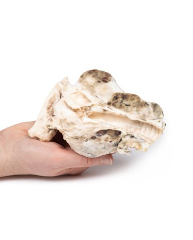 Gozzo multinodulare Erler Zimmer 3D anatomy Series MP2101