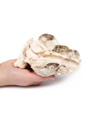 Gozzo multinodulare Erler Zimmer 3D anatomy Series MP2101