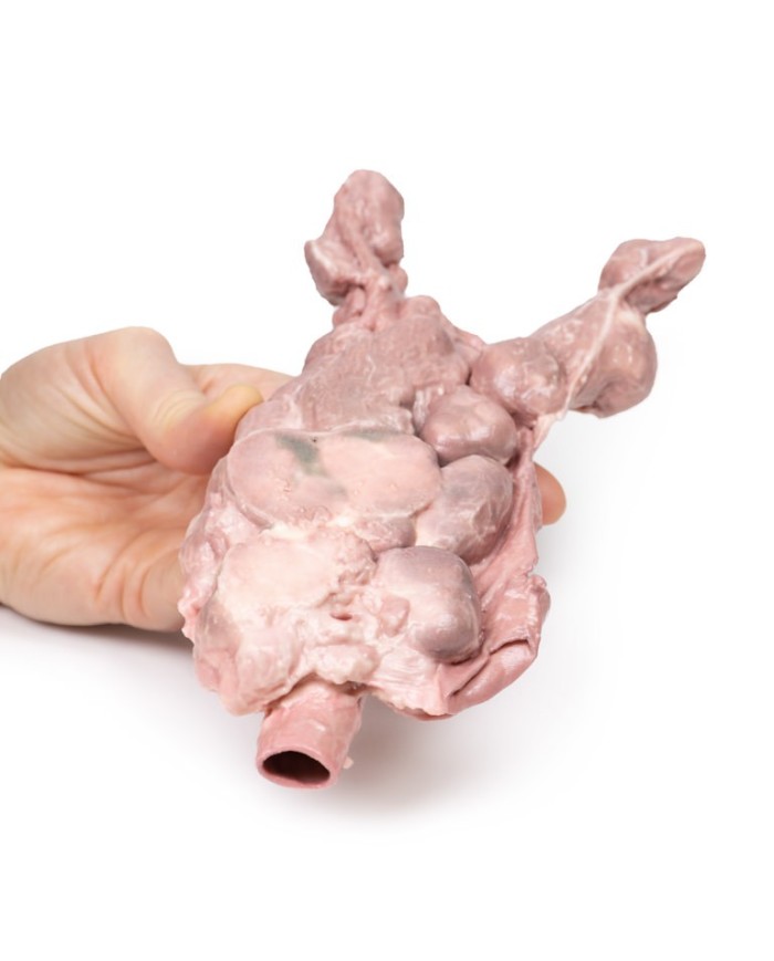 Linfonodi aortici e para aortici Erler Zimmer 3D anatomy Series MP2103