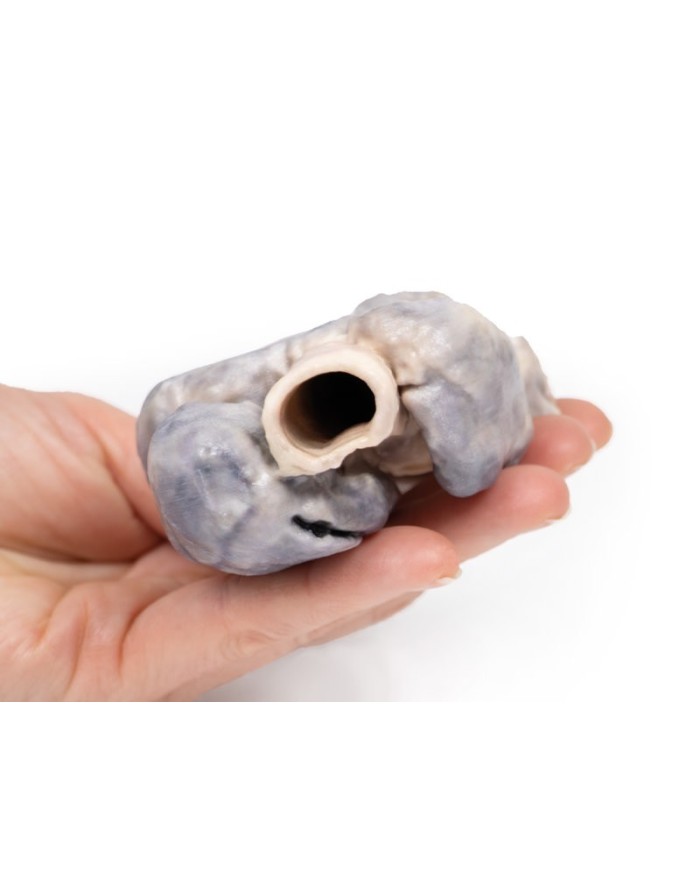 Gozzo retrosternale Erler Zimmer 3D anatomy Series MP2102