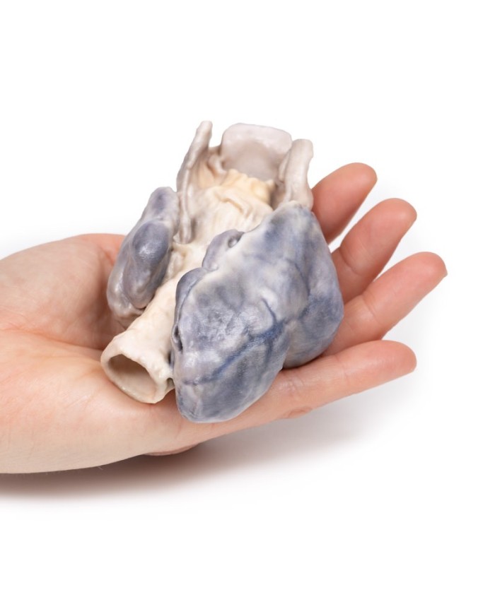 Gozzo retrosternale Erler Zimmer 3D anatomy Series MP2102