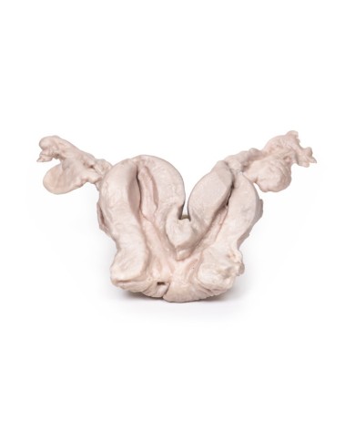 Utero bicorne Unicollis Erler Zimmer 3D anatomy Series MP2104