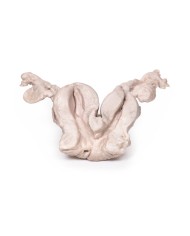 Utero bicorne Unicollis Erler Zimmer 3D anatomy Series MP2104