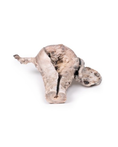 Carcinoma endometriale Erler Zimmer 3D anatomy Series MP2106