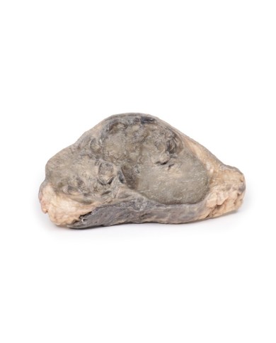 Carcinoma della mammella Erler Zimmer 3D anatomy Series MP2105