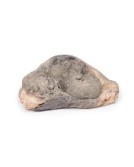 Carcinoma della mammella Erler Zimmer 3D anatomy Series MP2105