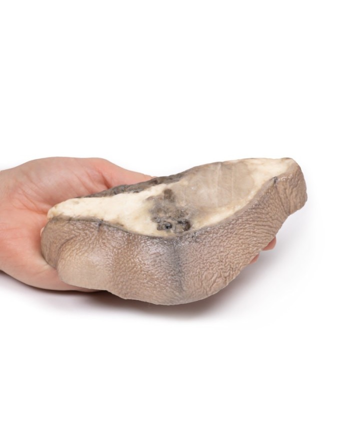 Carcinoma della mammella Erler Zimmer 3D anatomy Series MP2105