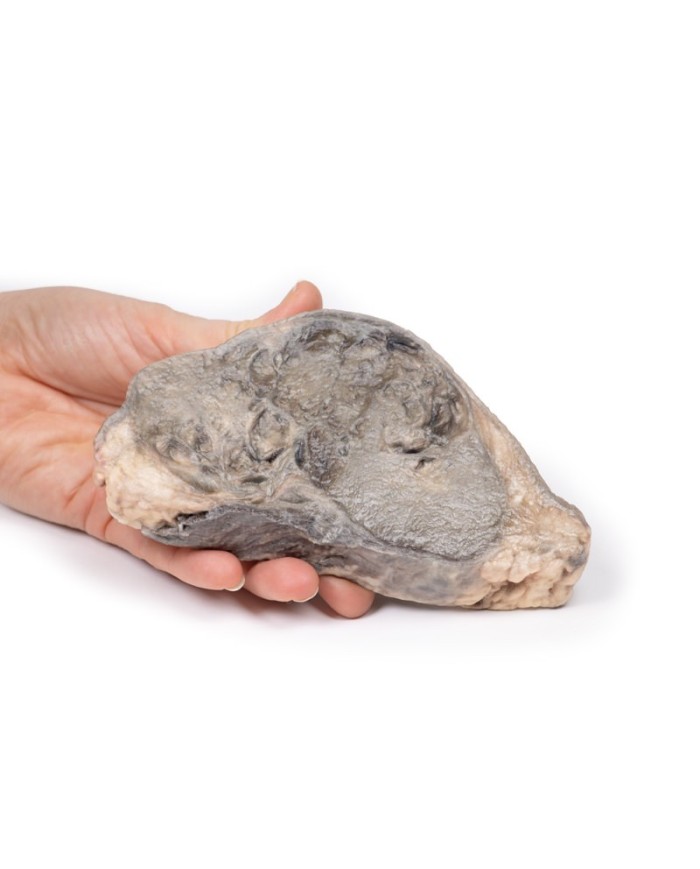 Carcinoma della mammella Erler Zimmer 3D anatomy Series MP2105