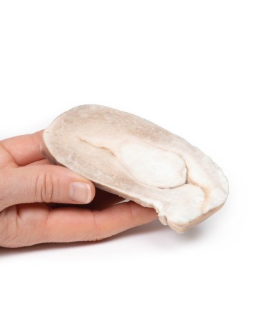 Leiomioma uterino Erler Zimmer 3D anatomy Series MP2107