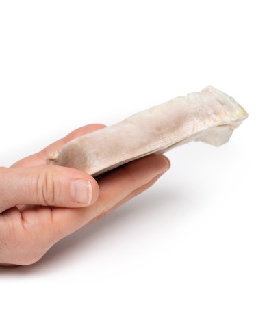 Leiomioma uterino Erler Zimmer 3D anatomy Series MP2107