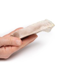 Leiomioma uterino Erler Zimmer 3D anatomy Series MP2107