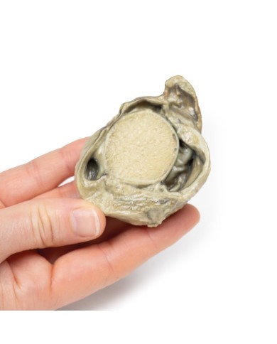 Idrocele Erler Zimmer 3D anatomy Series MP2109