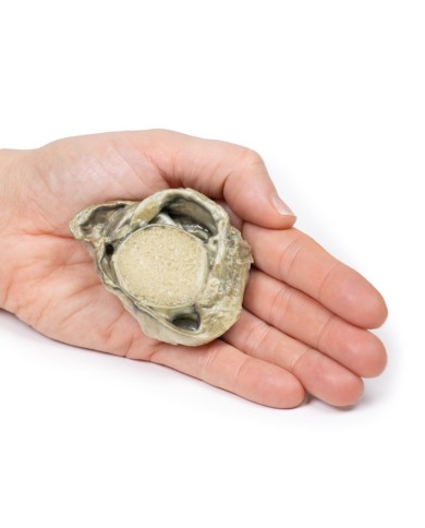 Idrocele Erler Zimmer 3D anatomy Series MP2109