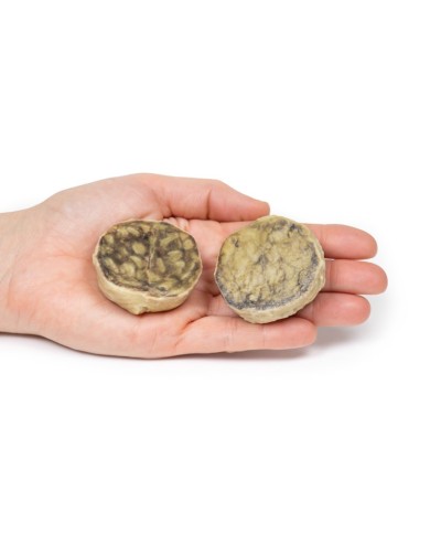 Iperplasia nodulare della prostata Erler Zimmer 3D anatomy Series MP2108