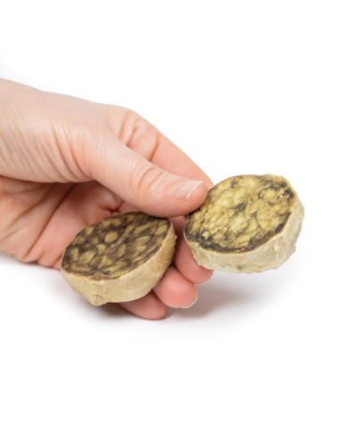 Iperplasia nodulare della prostata Erler Zimmer 3D anatomy Series MP2108