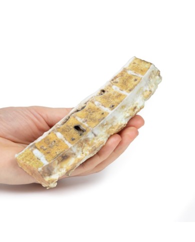 Tubercolosi Erler Zimmer 3D anatomy Series MP2111