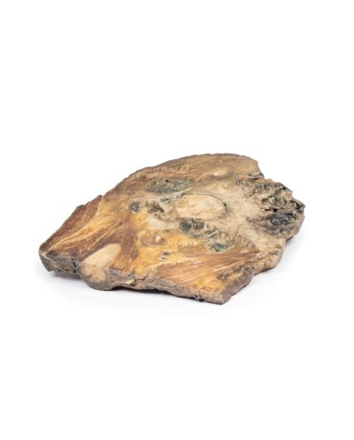 Condrosarcoma del femore e dell ileo Erler Zimmer 3D anatomy Series MP211