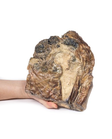 Condrosarcoma del femore e dell ileo Erler Zimmer 3D anatomy Series MP211