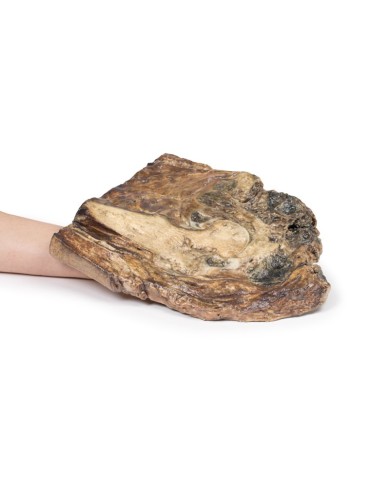 Condrosarcoma del femore e dell ileo Erler Zimmer 3D anatomy Series MP211