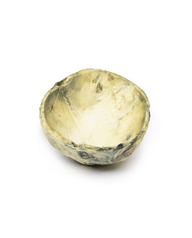 Sifilide terziaria Erler Zimmer 3D anatomy Series MP2113