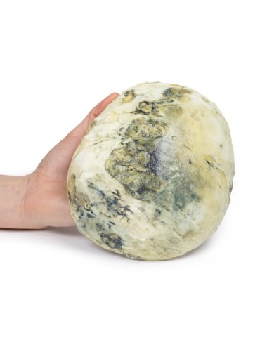 Sifilide terziaria Erler Zimmer 3D anatomy Series MP2113