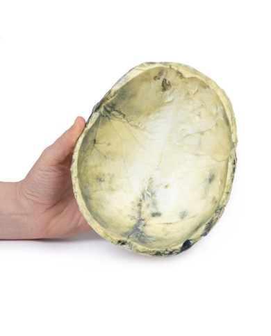 Sifilide terziaria Erler Zimmer 3D anatomy Series MP2113