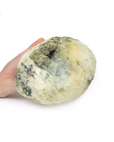 Sifilide terziaria Erler Zimmer 3D anatomy Series MP2113