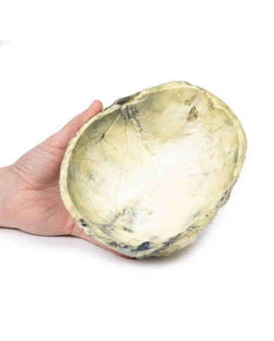 Sifilide terziaria Erler Zimmer 3D anatomy Series MP2113