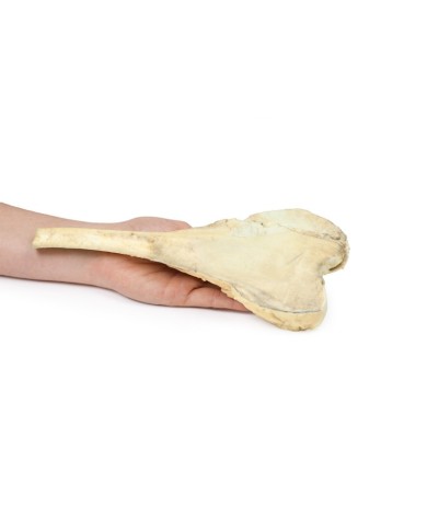 Osteosarcoma del femore Erler Zimmer 3D anatomy Series MP2115