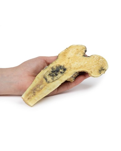 Osteosarcoma del femore Erler Zimmer 3D anatomy Series MP2116