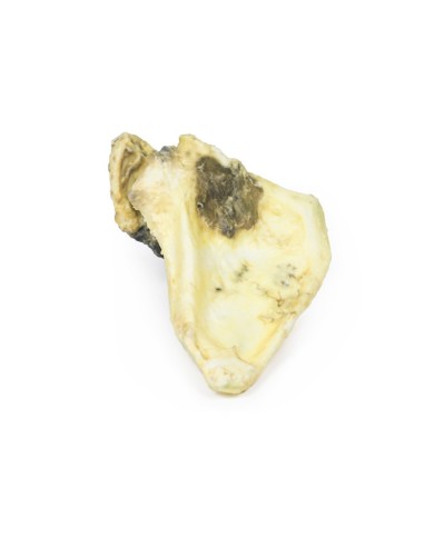 Condrosarcoma della scapola Erler Zimmer 3D anatomy Series MP2114