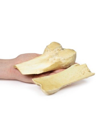 Osteocondroma Erler Zimmer 3D anatomy Series MP2118